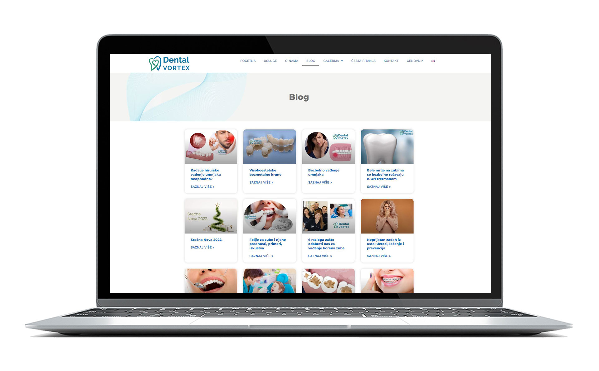 Ilustracija za post o studiji slučaja i iskustvu u radu sa stomatološkom ordinacijom Dental Vortex iz Beograda – prikaz stranice sa sajta.